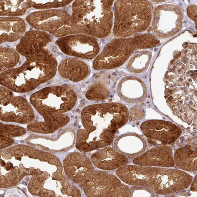 ATAT1 Antibody in Immunohistochemistry (Paraffin) (IHC (P))
