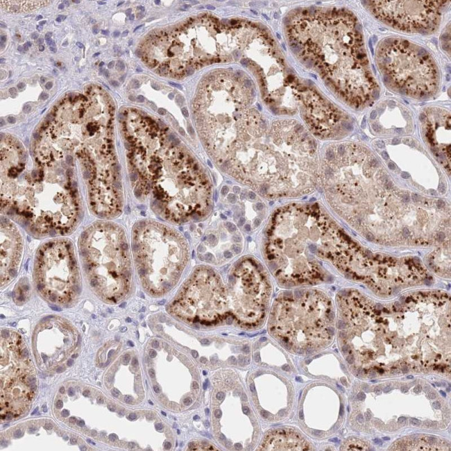 B4GALT4 Antibody in Immunohistochemistry (Paraffin) (IHC (P))