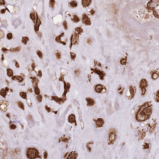 FAM47B Antibody in Immunohistochemistry (Paraffin) (IHC (P))