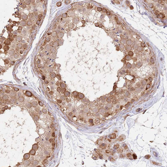 UQCC3 Antibody in Immunohistochemistry (Paraffin) (IHC (P))