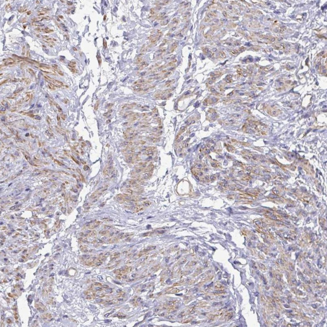 MYL6 Antibody in Immunohistochemistry (Paraffin) (IHC (P))