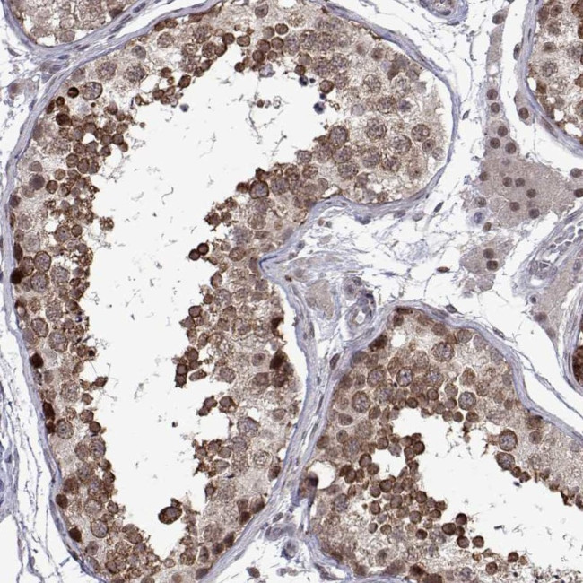 EFCAB3 Antibody in Immunohistochemistry (Paraffin) (IHC (P))
