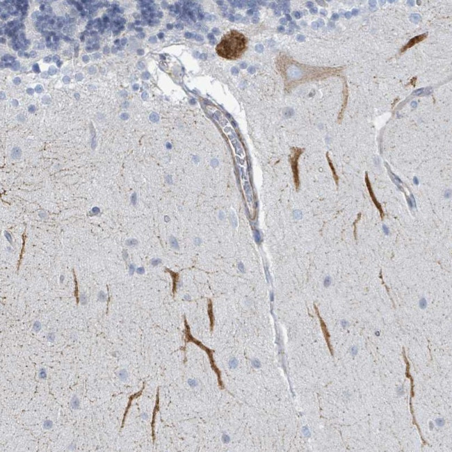 DMRTC1 Antibody in Immunohistochemistry (Paraffin) (IHC (P))