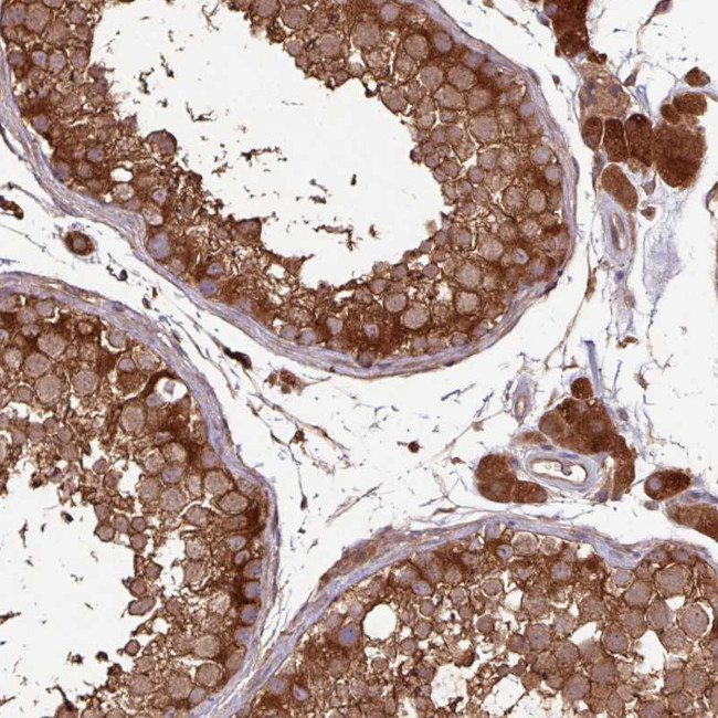 GNPDA1 Antibody in Immunohistochemistry (Paraffin) (IHC (P))