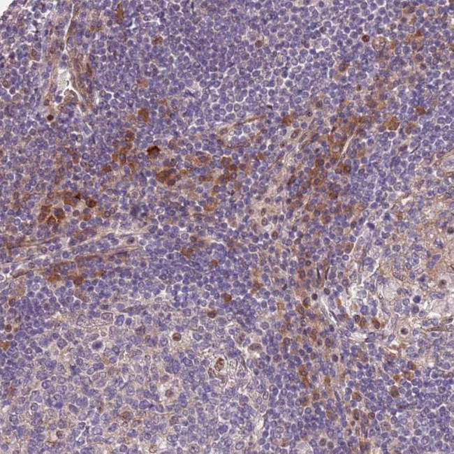 MAGEF1 Antibody in Immunohistochemistry (Paraffin) (IHC (P))