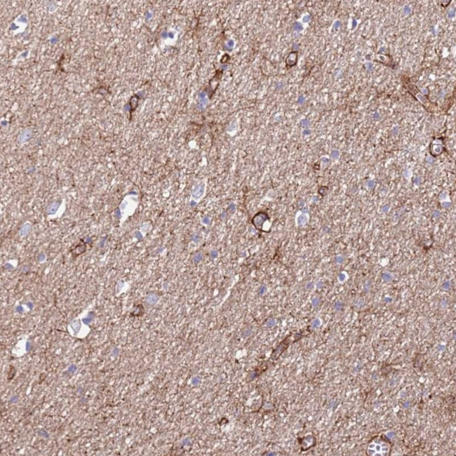 JAKMIP2 Antibody in Immunohistochemistry (Paraffin) (IHC (P))