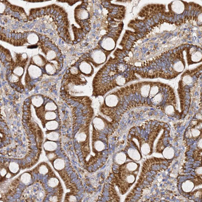 C19orf12 Antibody in Immunohistochemistry (Paraffin) (IHC (P))