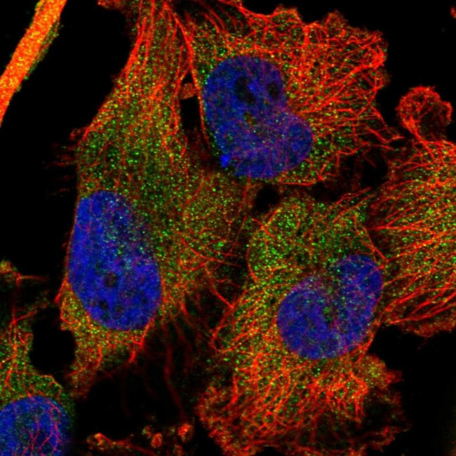 DDX60 Antibody in Immunocytochemistry (ICC/IF)