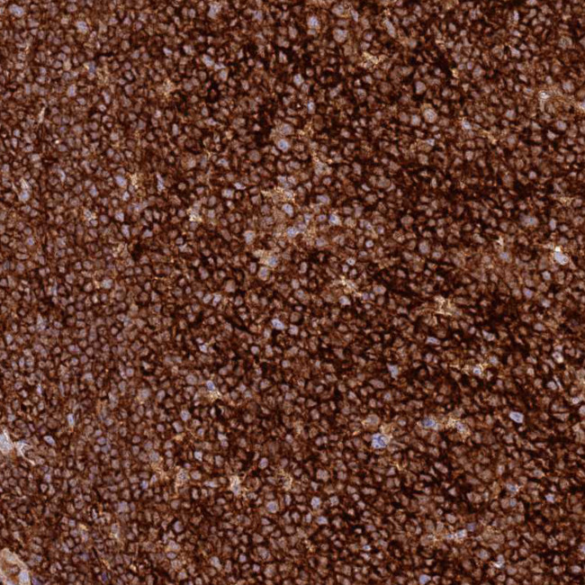 TTPAL Antibody in Immunohistochemistry (Paraffin) (IHC (P))