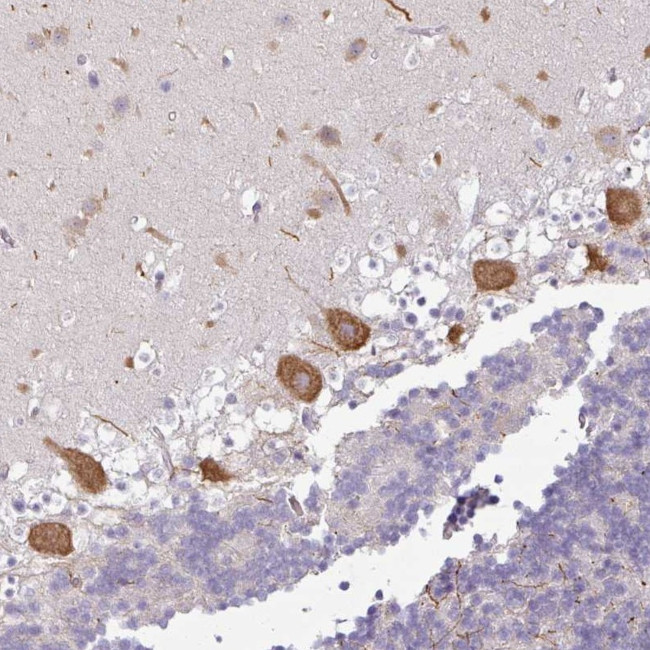 OR52D1 Antibody in Immunohistochemistry (Paraffin) (IHC (P))
