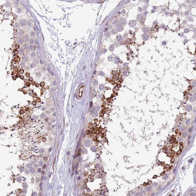 NBPF3 Antibody in Immunohistochemistry (Paraffin) (IHC (P))