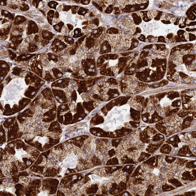 NDUFA3 Antibody in Immunohistochemistry (Paraffin) (IHC (P))