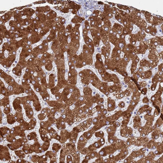 ZNF844 Antibody in Immunohistochemistry (Paraffin) (IHC (P))