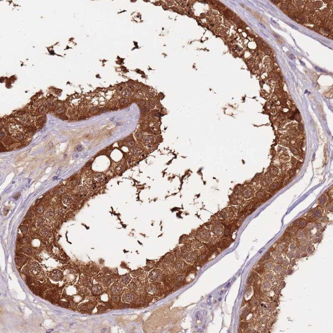 ARHGAP5 Antibody in Immunohistochemistry (Paraffin) (IHC (P))