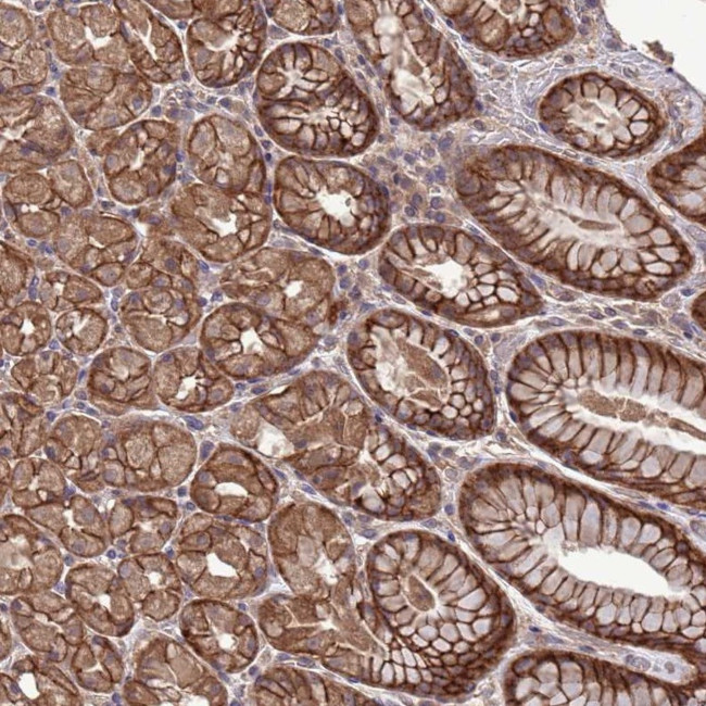 NHEDC2 Antibody in Immunohistochemistry (Paraffin) (IHC (P))