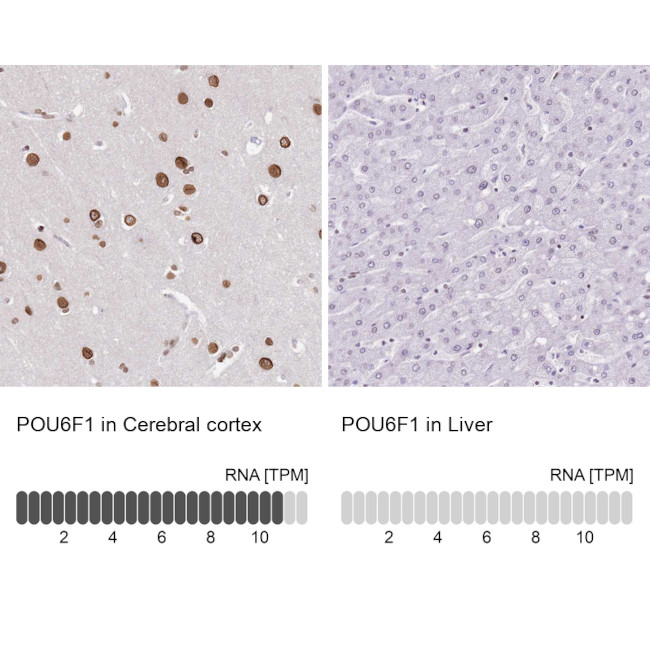 POU6F1 Antibody in Immunohistochemistry (IHC)
