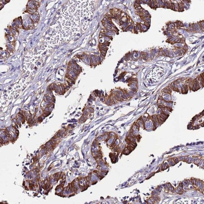 C19orf24 Antibody in Immunohistochemistry (Paraffin) (IHC (P))