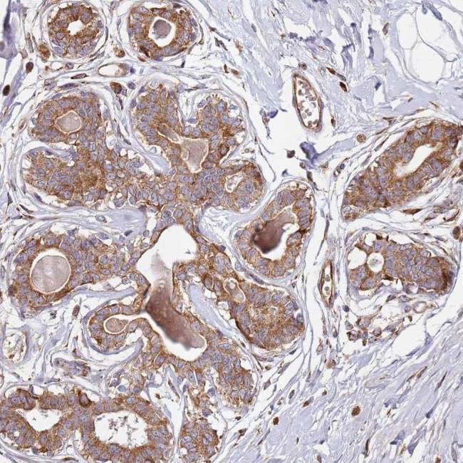 ARFRP1 Antibody in Immunohistochemistry (Paraffin) (IHC (P))
