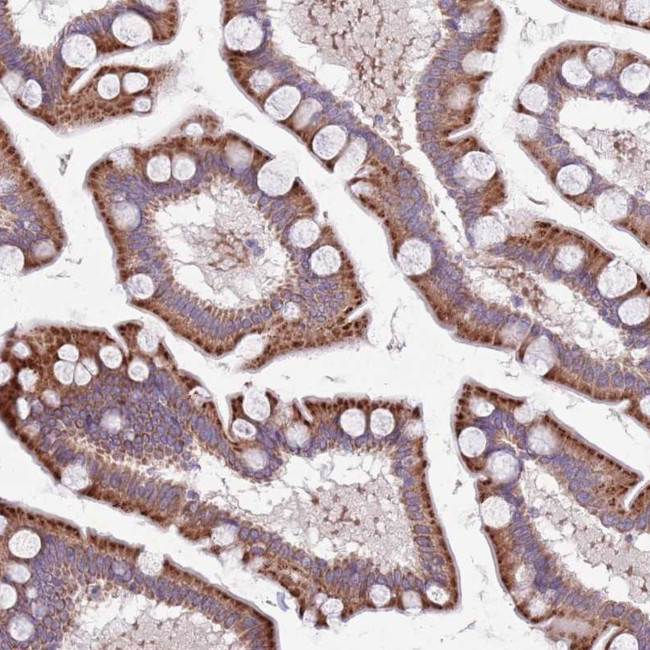 TYW1 Antibody in Immunohistochemistry (Paraffin) (IHC (P))