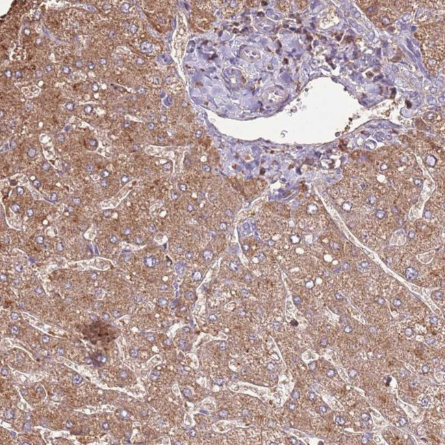 ARL10 Antibody in Immunohistochemistry (Paraffin) (IHC (P))