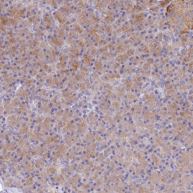 TYW1B Antibody in Immunohistochemistry (Paraffin) (IHC (P))