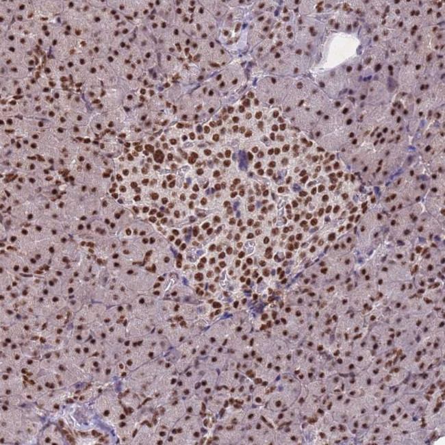 ESF1 Antibody in Immunohistochemistry (Paraffin) (IHC (P))