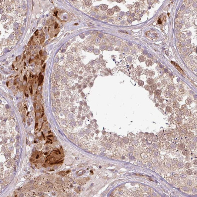 PDRG1 Antibody in Immunohistochemistry (Paraffin) (IHC (P))