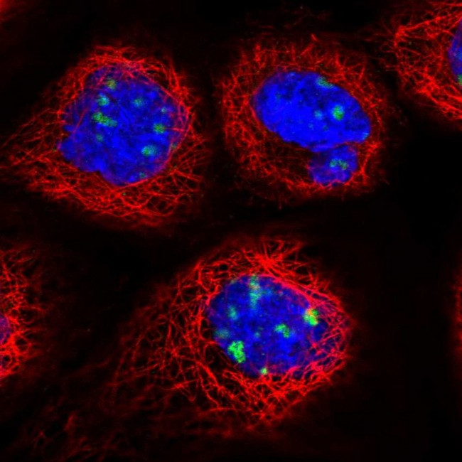 DDX27 Antibody in Immunocytochemistry (ICC/IF)
