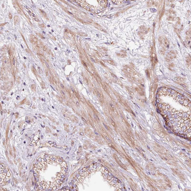 TPM3 Antibody in Immunohistochemistry (Paraffin) (IHC (P))