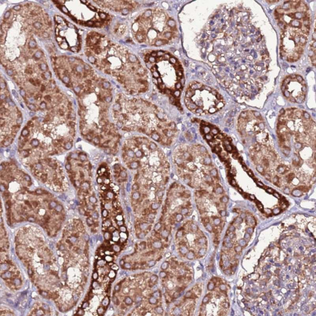 RPS15A Antibody in Immunohistochemistry (Paraffin) (IHC (P))