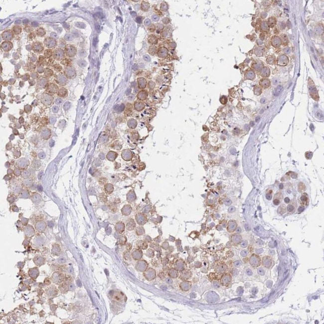 RPL39L Antibody in Immunohistochemistry (IHC)