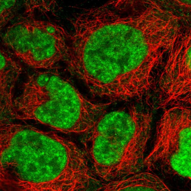 PRP6 Antibody in Immunocytochemistry (ICC/IF)