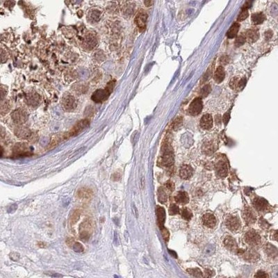 NSFL1C Antibody in Immunohistochemistry (IHC)