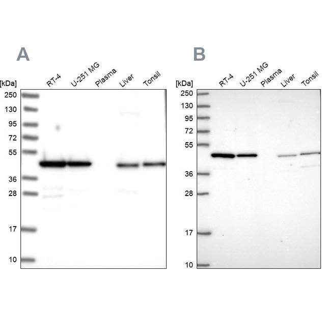 NSFL1C Antibody in Western Blot (WB)