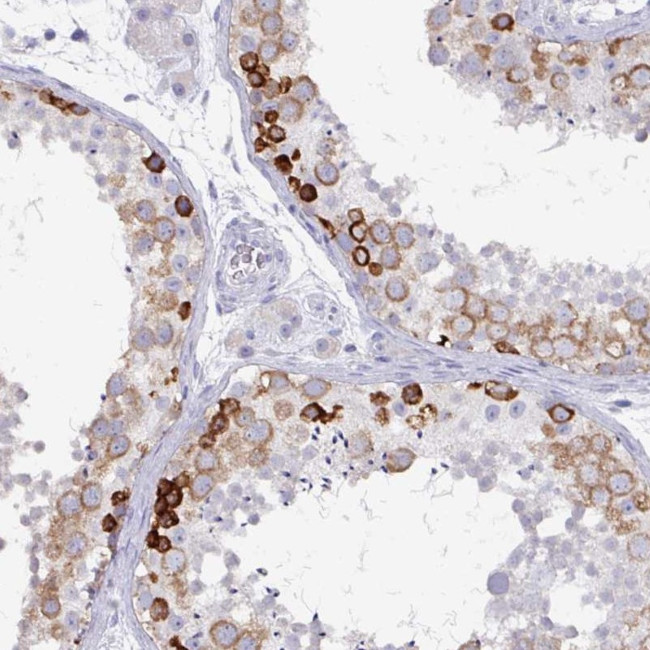 DAZ1 Antibody in Immunohistochemistry (Paraffin) (IHC (P))