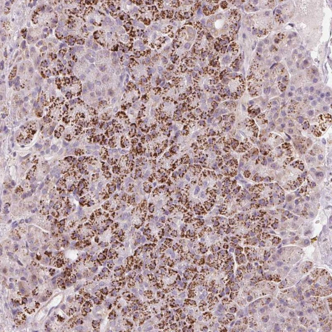 RNF39 Antibody in Immunohistochemistry (Paraffin) (IHC (P))
