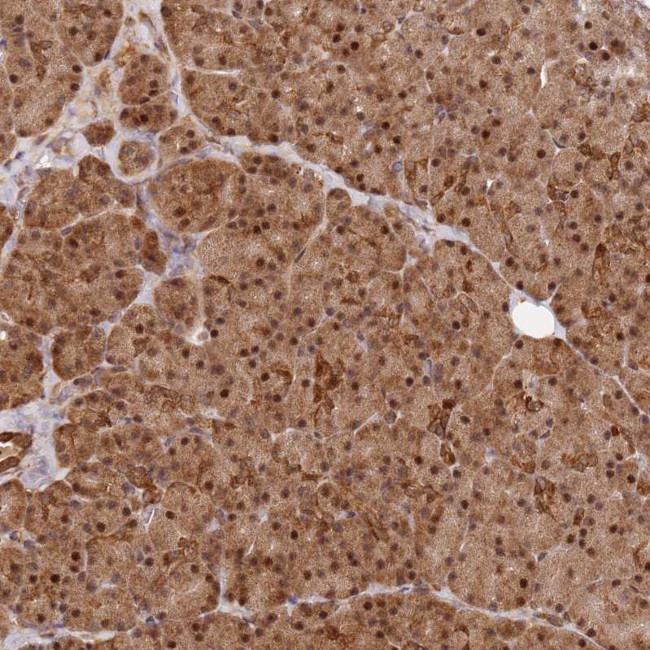 SMOX Antibody in Immunohistochemistry (Paraffin) (IHC (P))