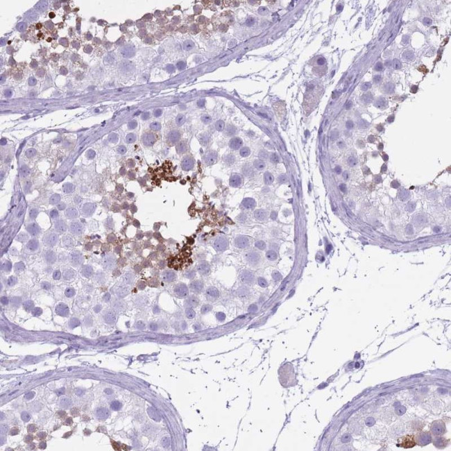 OR7C1 Antibody in Immunohistochemistry (Paraffin) (IHC (P))