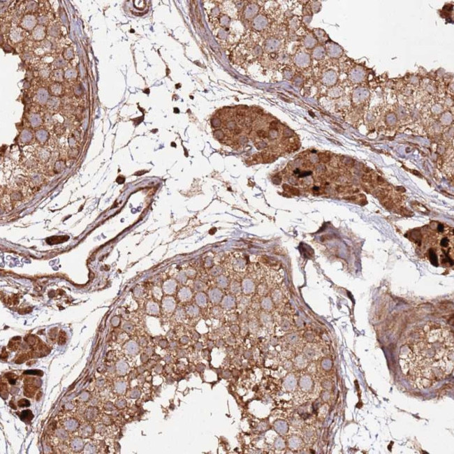 FAM186A Antibody in Immunohistochemistry (Paraffin) (IHC (P))