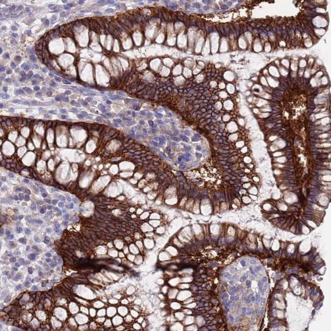 KRTCAP3 Antibody in Immunohistochemistry (Paraffin) (IHC (P))