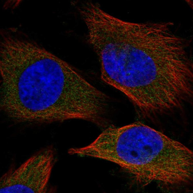 SPC25 Antibody in Immunocytochemistry (ICC/IF)