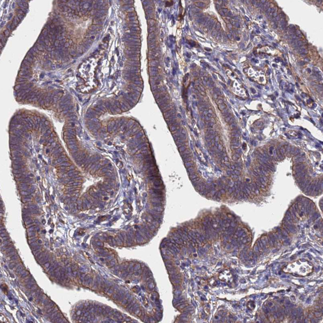 NDUFAF6 Antibody in Immunohistochemistry (Paraffin) (IHC (P))