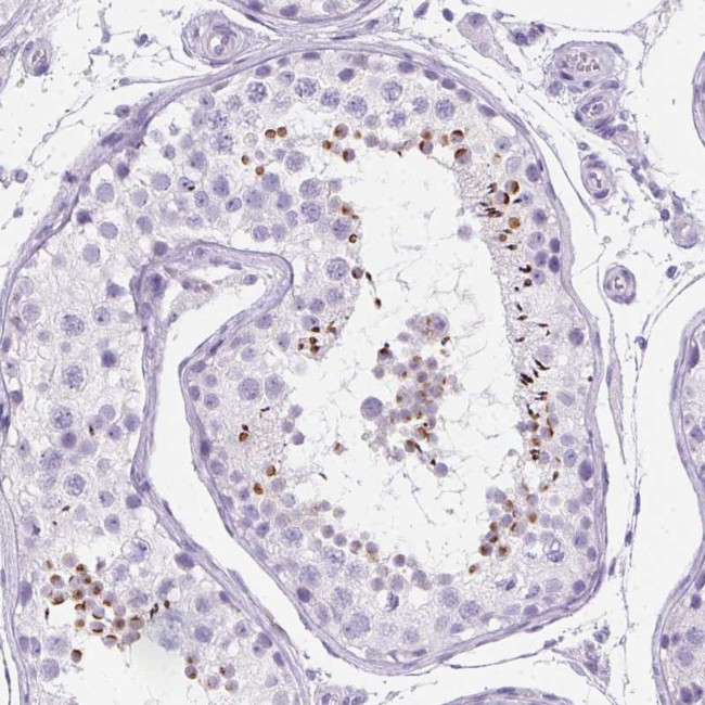 SPACA5 Antibody in Immunohistochemistry (Paraffin) (IHC (P))