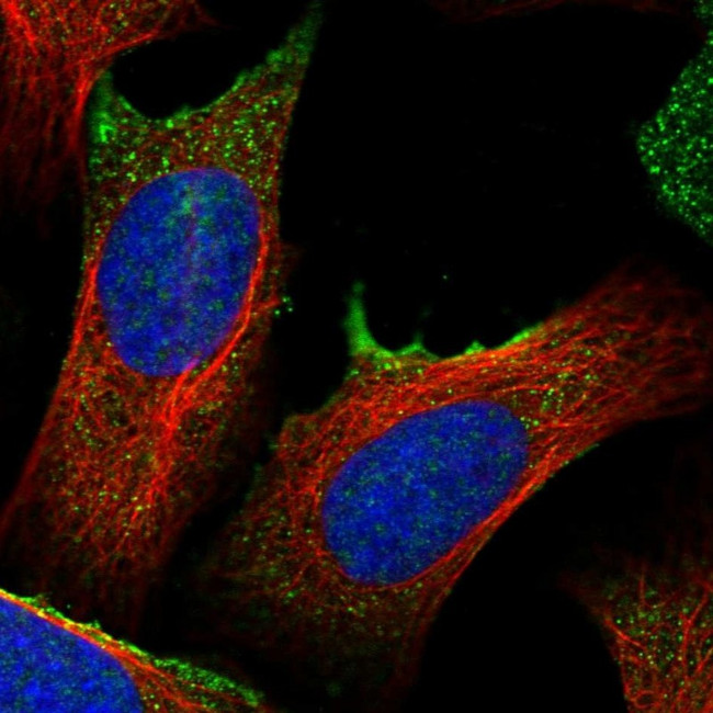 TM2D2 Antibody in Immunocytochemistry (ICC/IF)