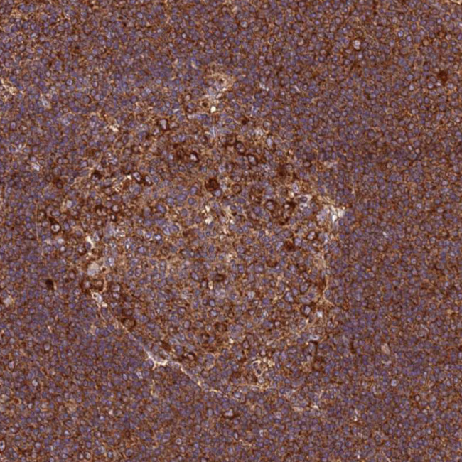 RPL36 Antibody in Immunohistochemistry (Paraffin) (IHC (P))