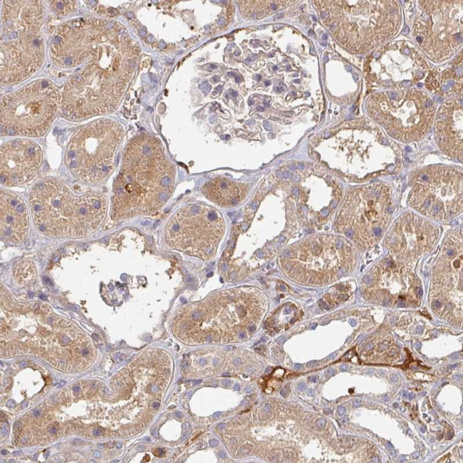 MRPS17 Antibody in Immunohistochemistry (Paraffin) (IHC (P))