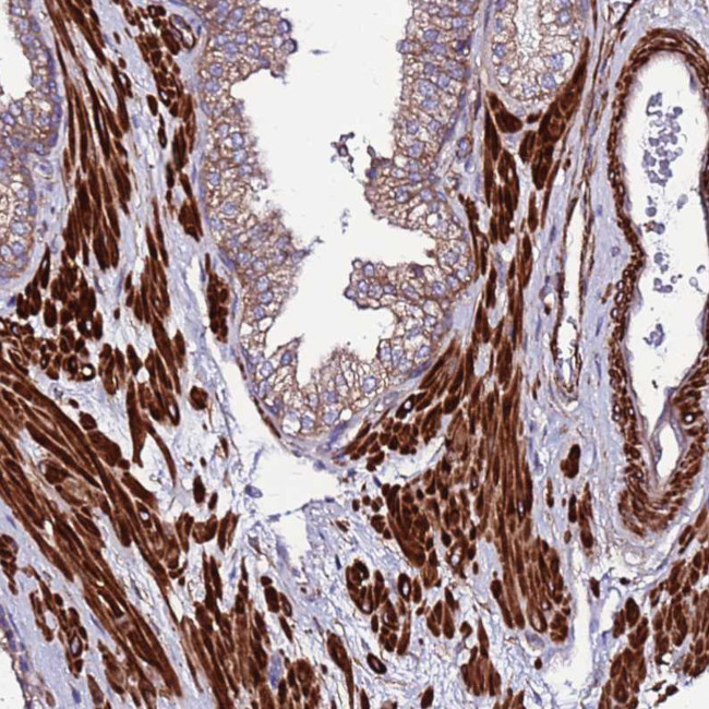 EI24 Antibody in Immunohistochemistry (Paraffin) (IHC (P))