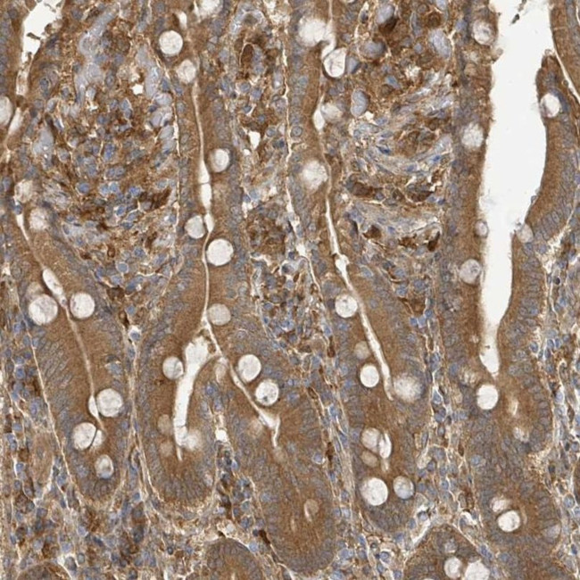 ARPIN Antibody in Immunohistochemistry (IHC)