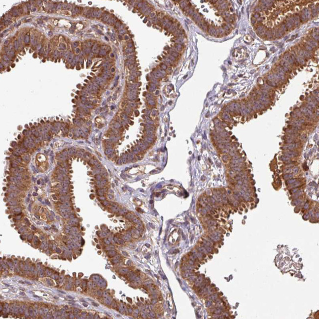 MRRF Antibody in Immunohistochemistry (Paraffin) (IHC (P))