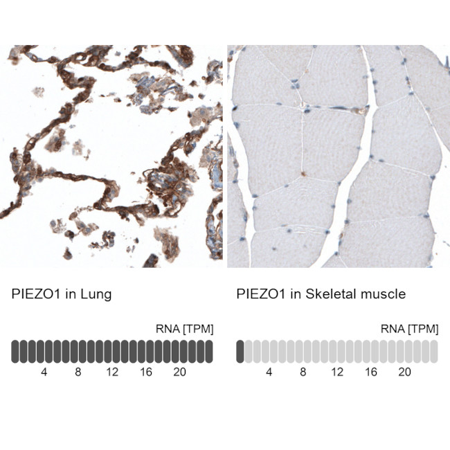 PIEZO1 Antibody